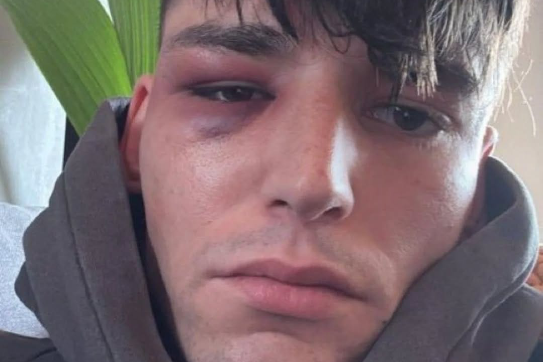 Openly gay German football referee, Pascal Kaiser, attacked after viral on-field proposal to boyfriend