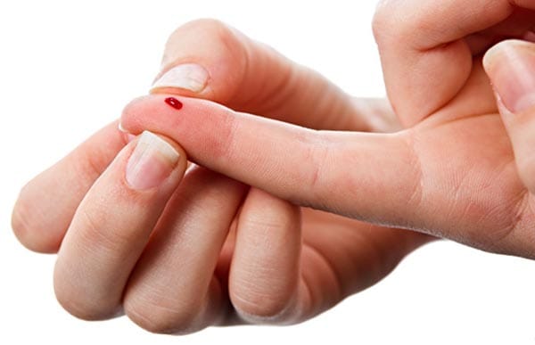 Study suggests routine HIV test is offered at GP surgery for new patients