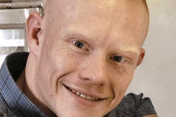 Survey finds Assurance prospects improving for people with HIV