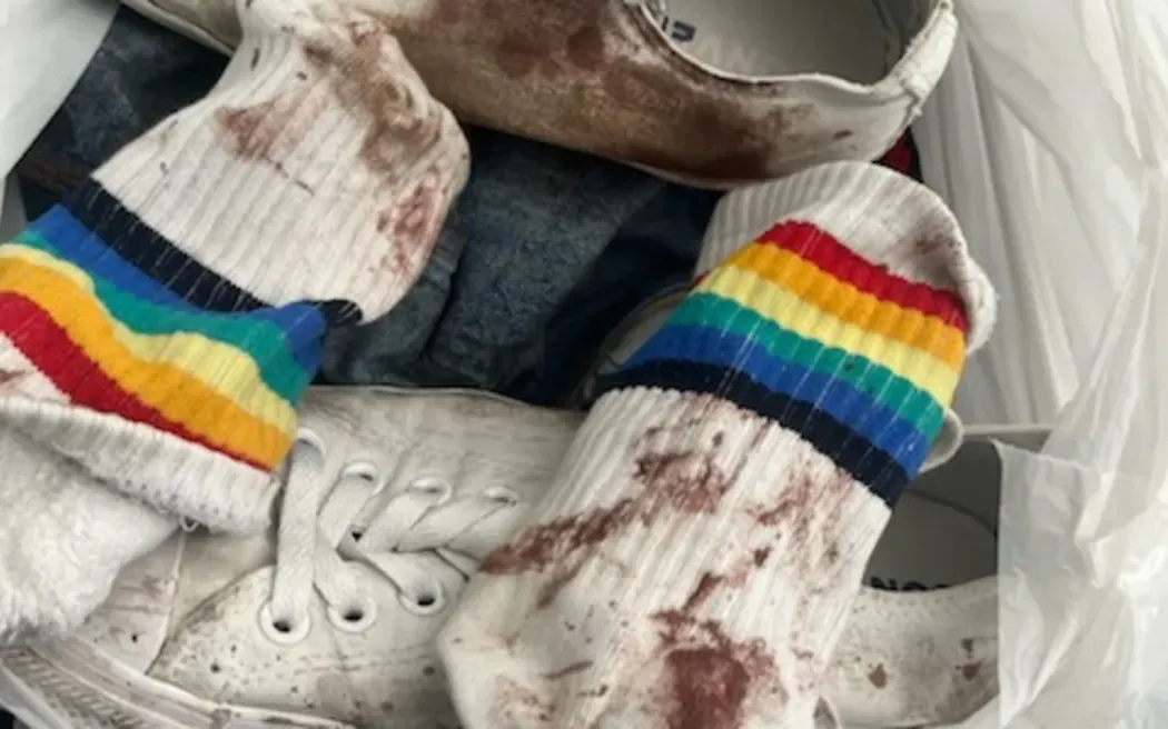 *GRAPHIC CONTENT*: Gay man violently attacked in New Zealand