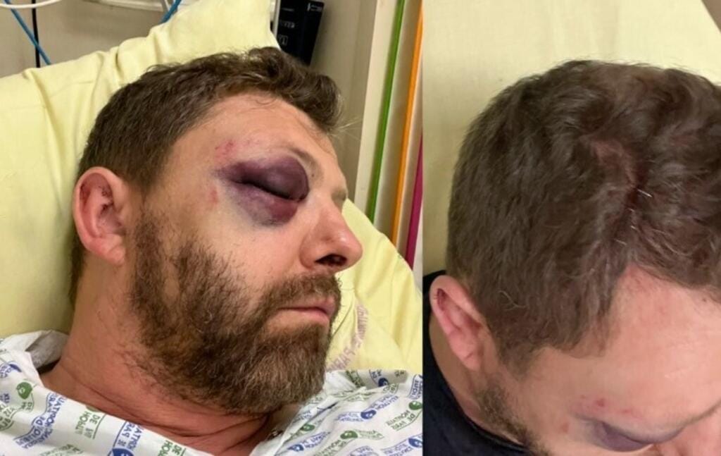 French LGBTQ+ rights leader, Pierre Picavet, hospitalised after homophobic attack in Paris
