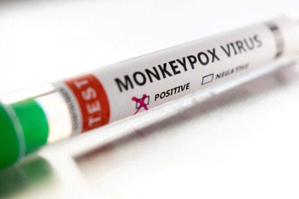 UK Health Security Agency finds vaccination offers strong protection against monkeypox
