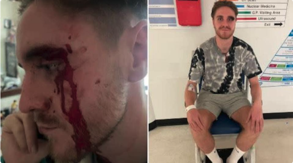 Gay man hospitalised in London after being attacked by gang wielding ‘wooden panel with nails in’