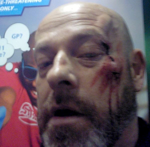 Man injured in unprovoked attack on Brighton Seafront