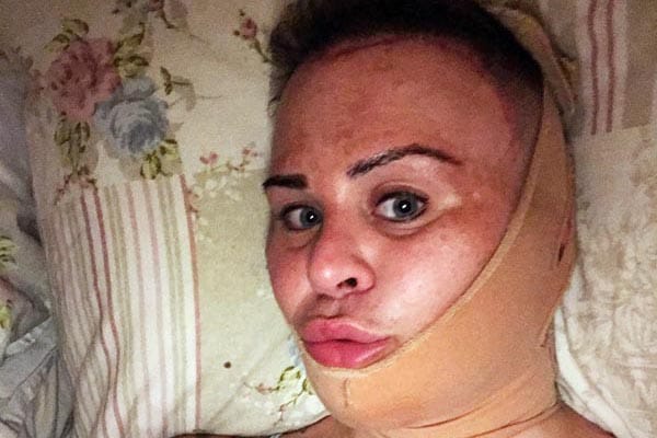 FEATURE: Transitioning with Sugar – A year in her life 