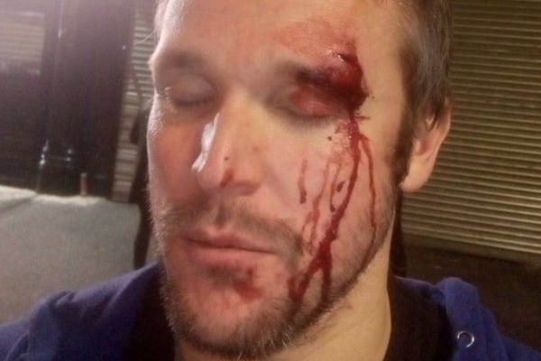 Birmingham sees another homophobic hate crime