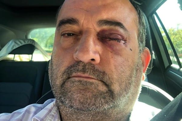 Man left with fractured eye socket after attack in Birmingham’s Gay Village