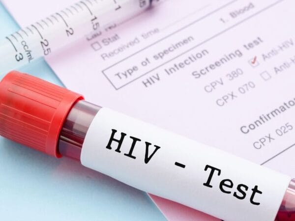 Heterosexual HIV diagnoses overtake those in gay and bisexual men for first time in Scotland since 2007