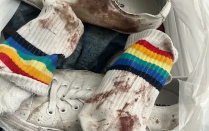 *GRAPHIC CONTENT*: Gay man violently attacked in New Zealand