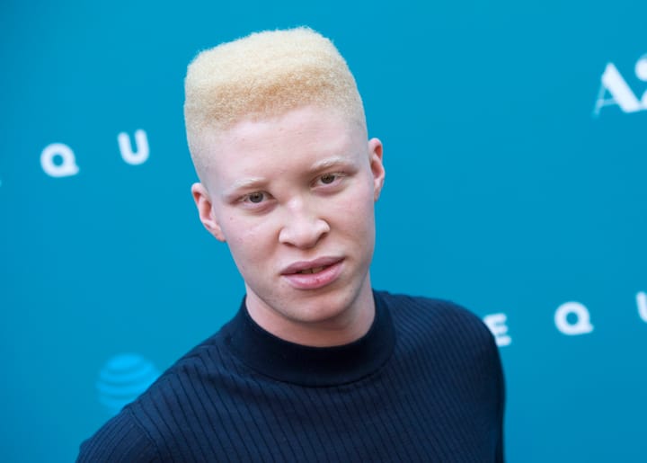 Shaun Ross, one of only a few high-profile models with albinism, shares a touching story of coming out to his grandfather
