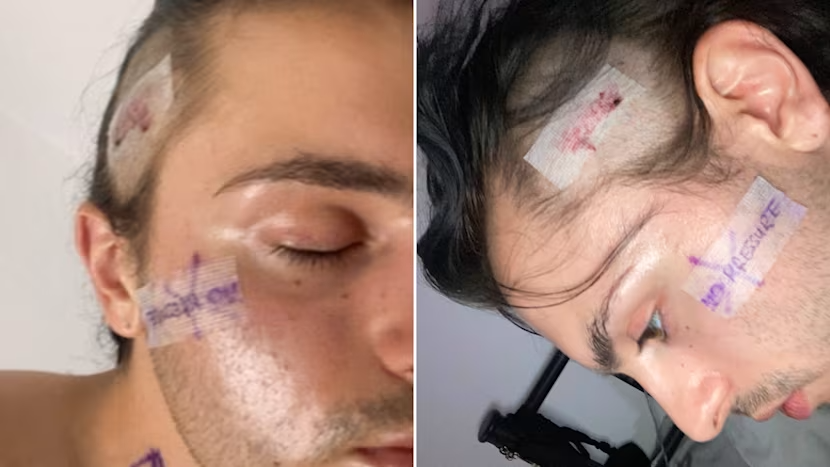 Fashion worker launches fundraiser after homophobic attack leaves him unable to work