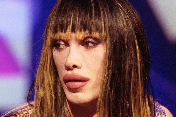 Pete Burns